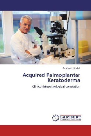 Acquired Palmoplantar Keratoderma