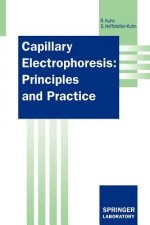 Capillary Electrophoresis: Principles and Practice