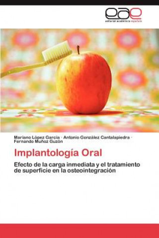 Implantologia Oral