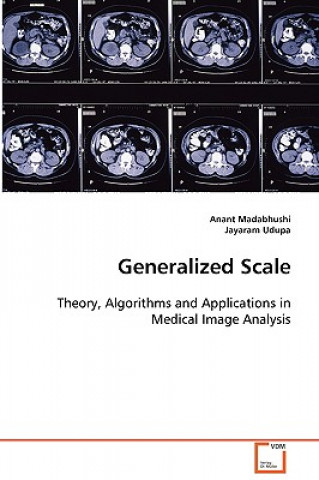 Generalized Scale