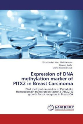 Expression of DNA methylation marker of PITX2 in Breast Carcinoma