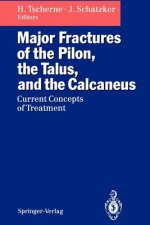 Major Fractures of the Pilon, the Talus, and the Calcaneus