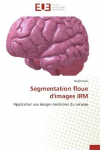 Segmentation floue d'images IRM