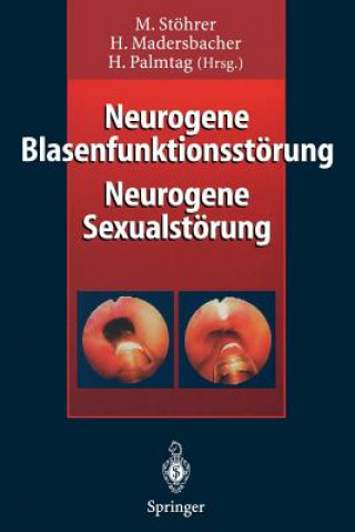 Neurogene Blasenfunktionsstorung Neurogene Sexualstorung