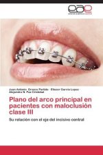 Plano del arco principal en pacientes con maloclusion clase III