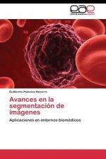Avances en la segmentacion de imagenes