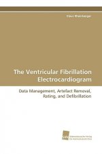 Ventricular Fibrillation Electrocardiogram