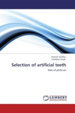 Selection of artificial teeth