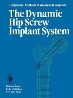 Dynamic Hip Screw Implant System