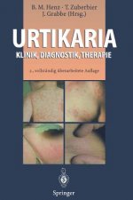 Urtikaria