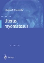 Uterus Myomatosus