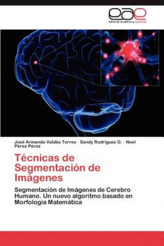 Tecnicas de Segmentacion de Imagenes