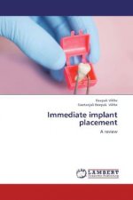 Immediate implant placement