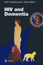 HIV and Dementia