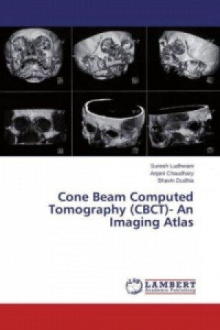 Cone Beam Computed Tomography (CBCT)- An Imaging Atlas