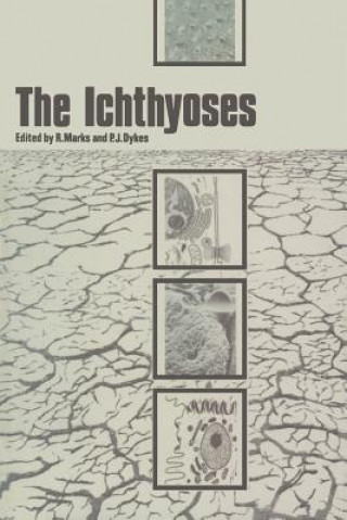 Ichthyoses