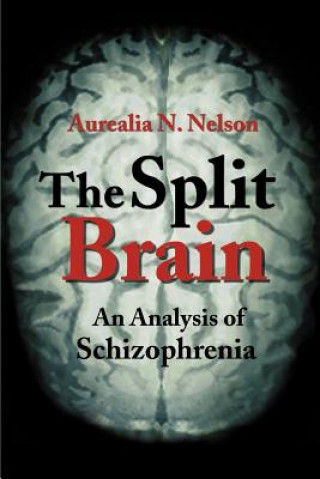 Split Brain
