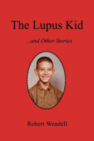 Lupus Kid and Other Stories