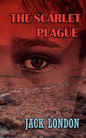 Scarlet Plague