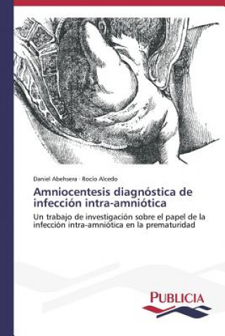 Amniocentesis diagnostica de infeccion intra-amniotica