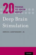 20 Things to Know about Deep Brain Stimulation