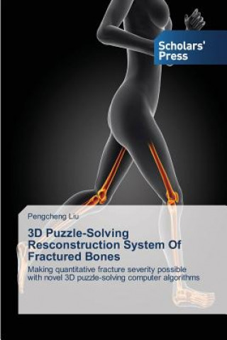 3D Puzzle-Solving Resconstruction System of Fractured Bones