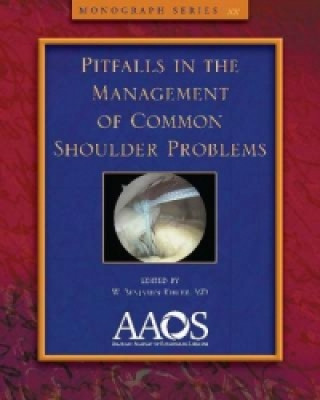 Pitfalls in the Management of Common Shoulder Problems