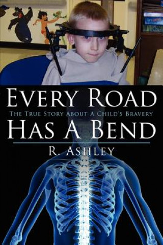 Every Road Has A Bend