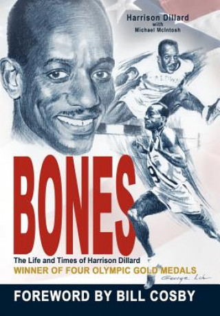Bones
