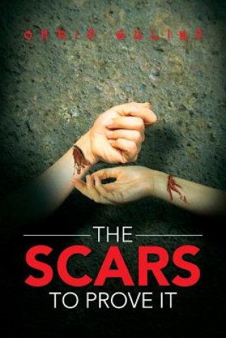 Scars to Prove It