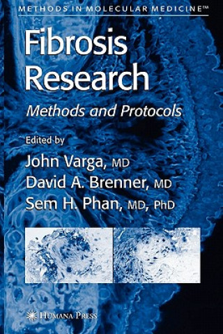 Fibrosis Research