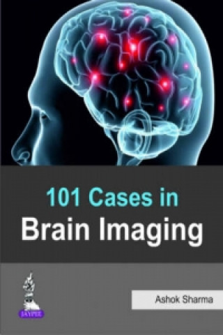 101 Cases in Brain Imaging
