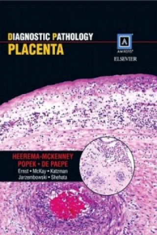 Diagnostic Pathology: Placenta