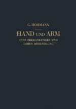Hand Und Arm