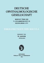Erkrankungen Der Macula