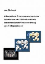 Atlasbasierte Erkennung anatomischer Strukturen und Landmarken fur die dreidimensionale virtuelle Planung von Huftoperationen