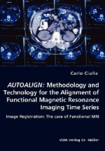 Autoalign