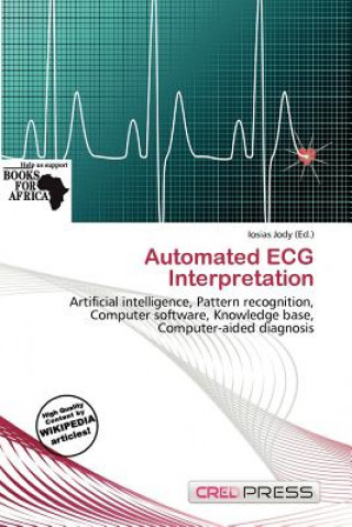 Automated ECG Interpretation