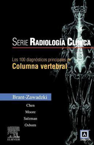 100 Diagnosticos Principales En Columna Vertebral