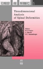 Three Dimensional Analysis of Spinal Deformities