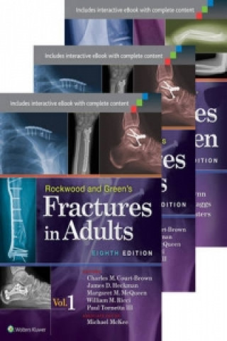 Rockwood, Green, and Wilkins' Fractures in Adults and Children  Package