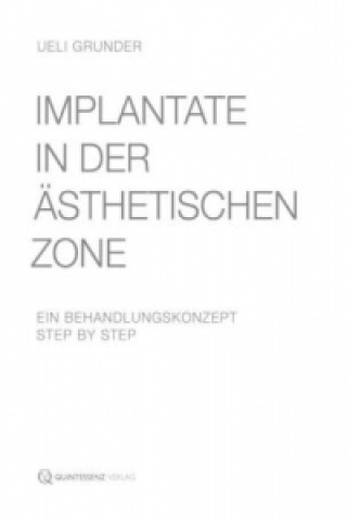 Implantate in der ästhetischen Zone