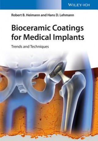 Bioceramic Coatings for Medical Implants - Trends and Techniques