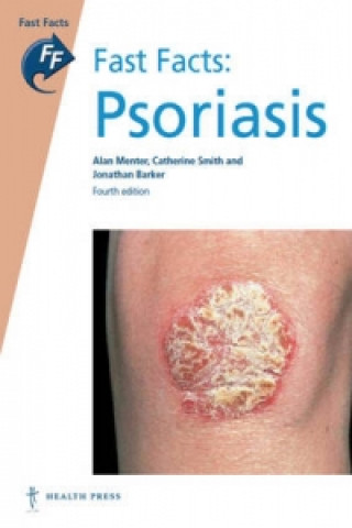 Fast Facts: Psoriasis