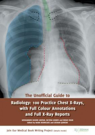 Unofficial Guide to Radiology: 100 Practice Chest X Rays with Full Colour Annotations and Full X Ray Reports