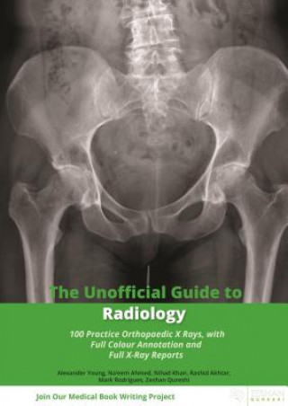 Unofficial Guide to Radiology: 100 Practice Orthopaedic X Rays with Full Colour Annotations and Full X Ray Reports