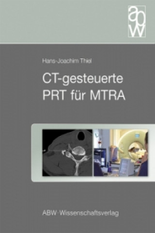 CT-gesteuerte PRT für MTRA