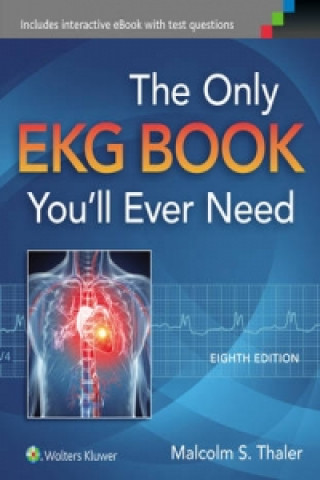 Only Ekg Book You'll Ever Need