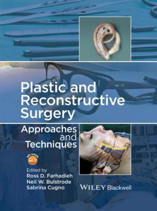 Plastic and Reconstructive Surgery - Approaches and Techniques