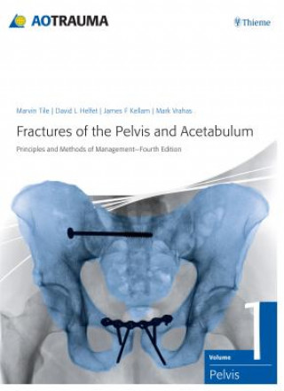 Fractures of the Pelvis and Acetabulum (AO)
